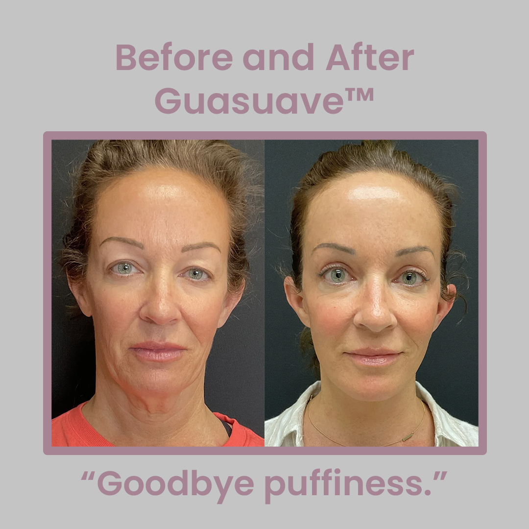Guasuave™- Skin Smoothing Tool
